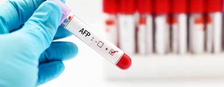 Visitar la promoción de Alfafetoproteína (AFP)