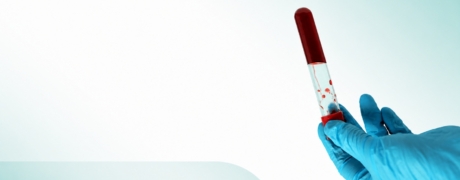 Visitar la promoción de Antigeno de superficie hepatitis B HBSAG (QML)