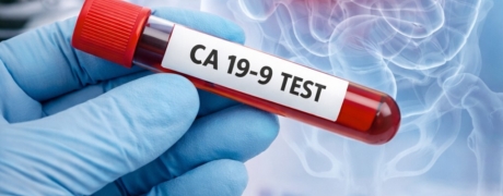 Visitar la promoción de Examen de CA 19-9