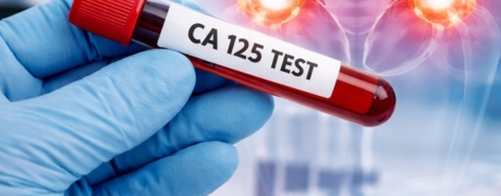 Visitar la promoción de Examen de CA 125