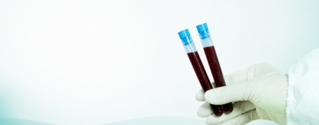 Visitar la promoción de Anticuerpos anti hepatitis c