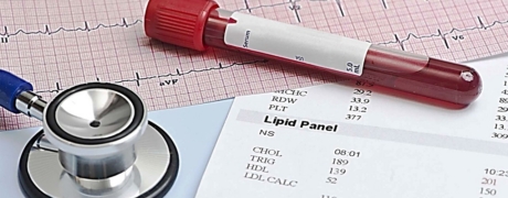 Visitar la promoción de Perfil de lípidos