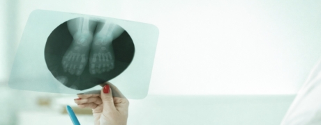 Visitar la promoción de Rx Medición de miembros inferiores