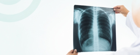 Visitar la promoción de Radiografia de tórax